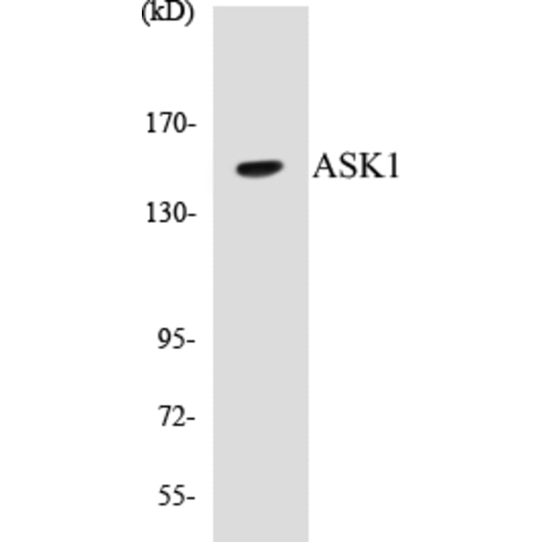 Western Blot - ASK1 Cell Based ELISA Kit (CB5050) - Antibodies.com
