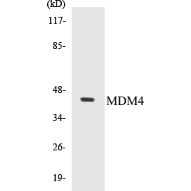Western Blot - MDM4 Cell Based ELISA Kit (CB5437) - Antibodies.com