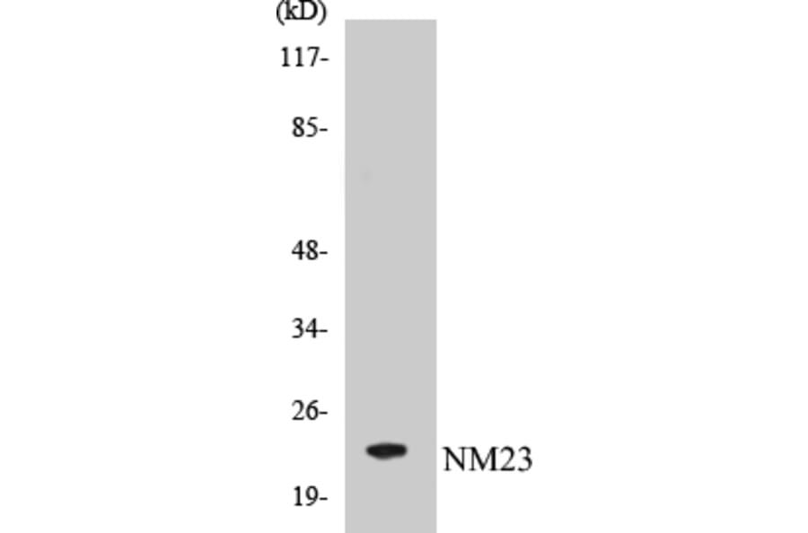 Western Blot - NM23 Cell Based ELISA Kit (CB5491) - Antibodies.com