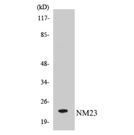 Western Blot - NM23 Cell Based ELISA Kit (CB5491) - Antibodies.com