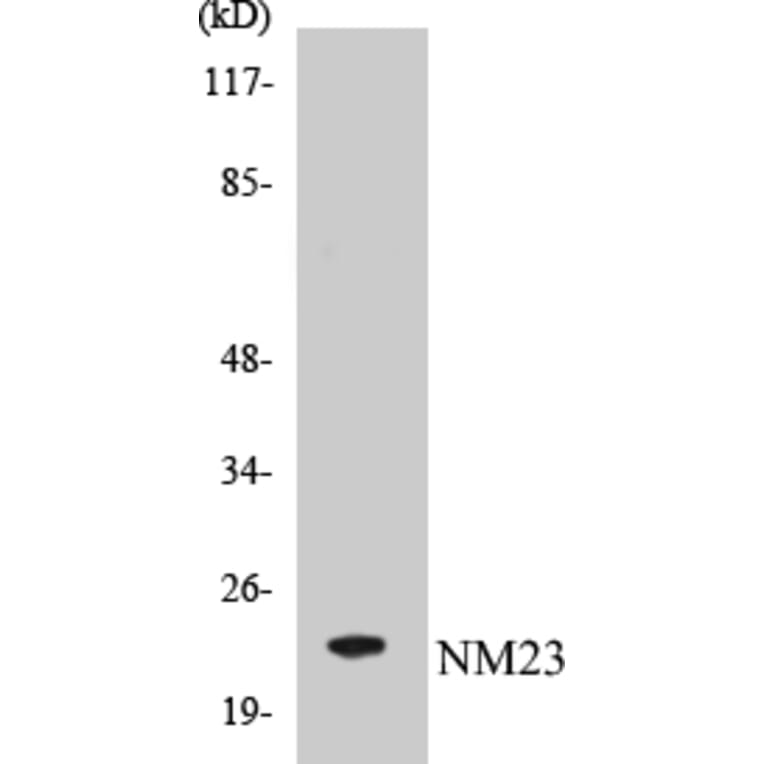 Western Blot - NM23 Cell Based ELISA Kit (CB5491) - Antibodies.com