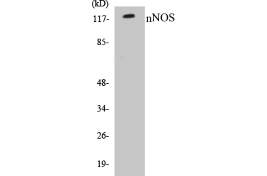 Western Blot - nNOS Cell Based ELISA Kit (CB5494) - Antibodies.com