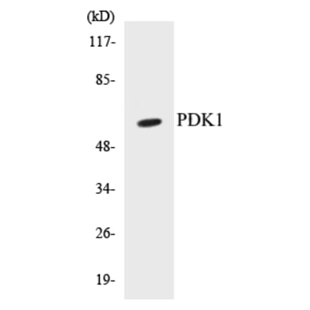 Western Blot - PDK1 Cell Based ELISA Kit (CB5546) - Antibodies.com