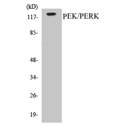 Western Blot - PERK Cell Based ELISA Kit (CB5548) - Antibodies.com