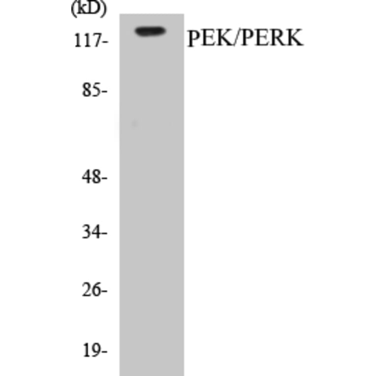 Western Blot - PERK Cell Based ELISA Kit (CB5548) - Antibodies.com