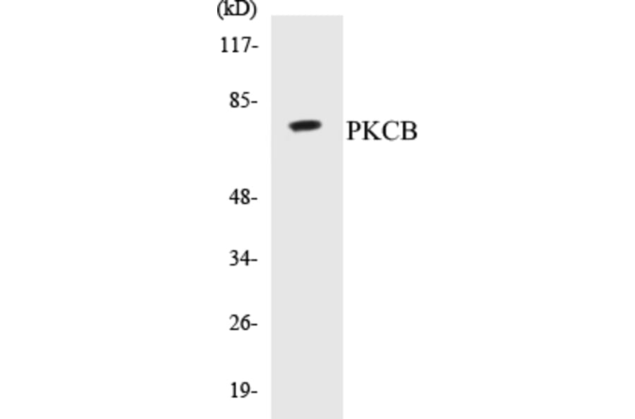 Western Blot - PKCB Cell Based ELISA Kit (CB5567) - Antibodies.com