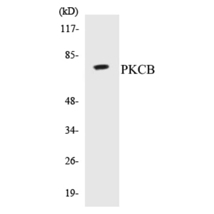 Western Blot - PKCB Cell Based ELISA Kit (CB5567) - Antibodies.com