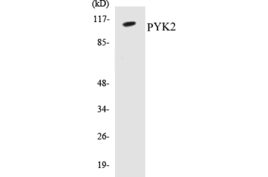 Western Blot - PYK2 Cell Based ELISA Kit (CB5595) - Antibodies.com