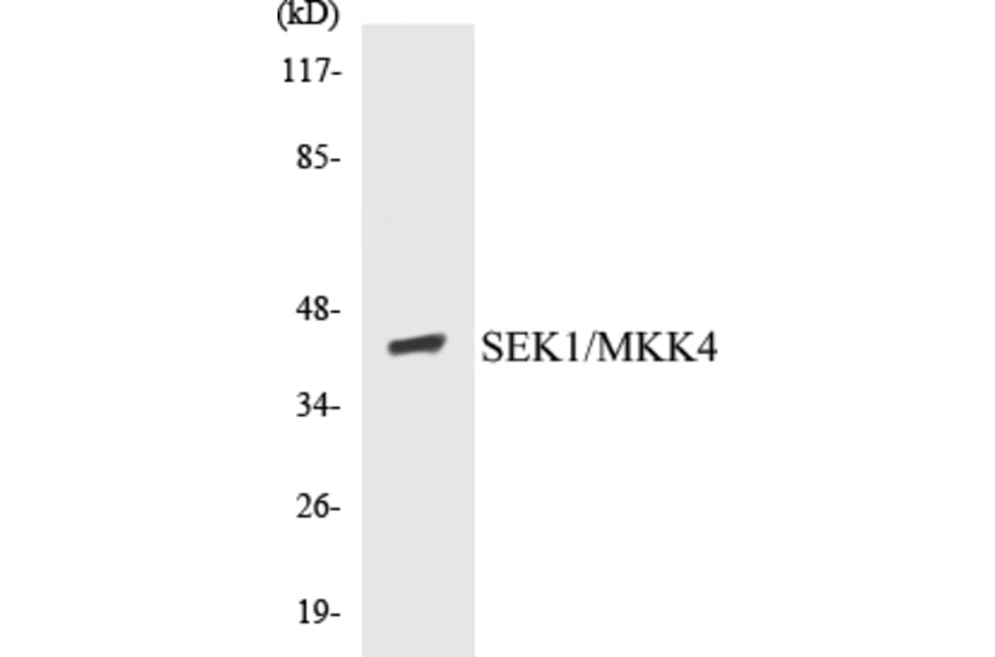 Western Blot - MKK4 Cell Based ELISA Kit (CB5619) - Antibodies.com