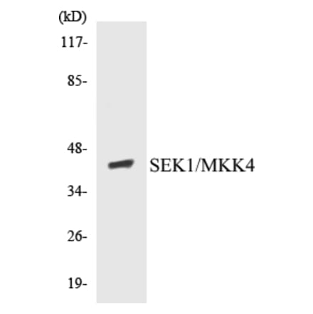 Western Blot - MKK4 Cell Based ELISA Kit (CB5619) - Antibodies.com