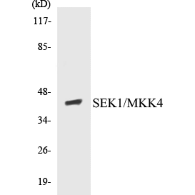 Western Blot - MKK4 Cell Based ELISA Kit (CB5619) - Antibodies.com