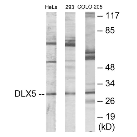Western Blot - DLX5 Cell Based ELISA Kit (CB5930) - Antibodies.com