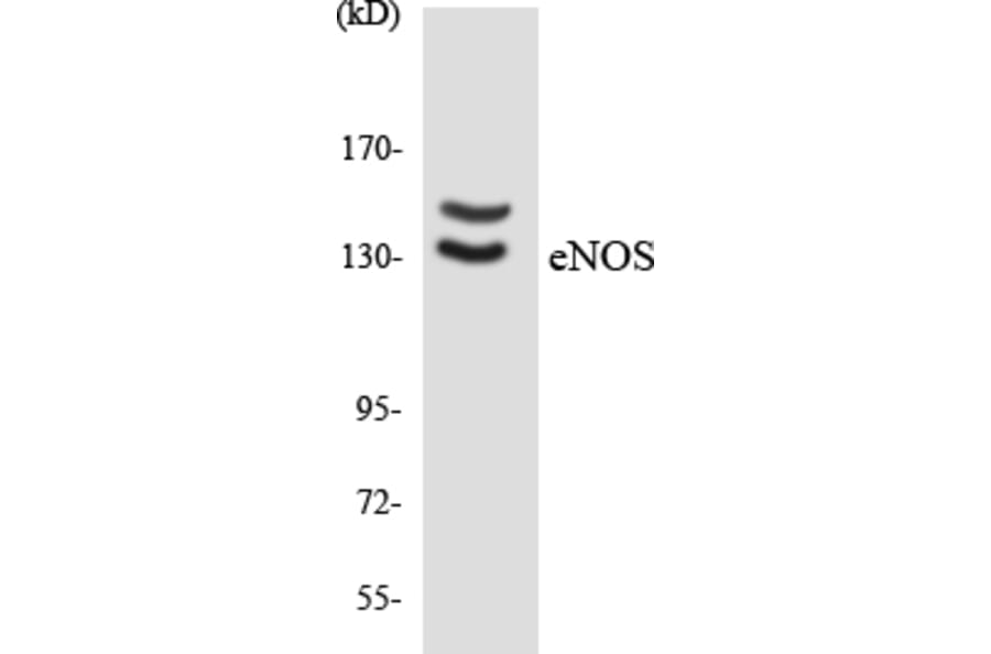 Western Blot - eNOS Cell Based ELISA Kit (CB6154) - Antibodies.com
