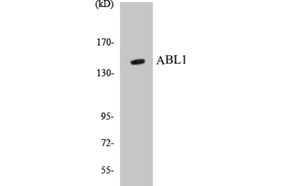 Western Blot - ABL1 Cell Based ELISA Kit (CB5015) - Antibodies.com