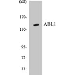 Western Blot - ABL1 Cell Based ELISA Kit (CB5015) - Antibodies.com