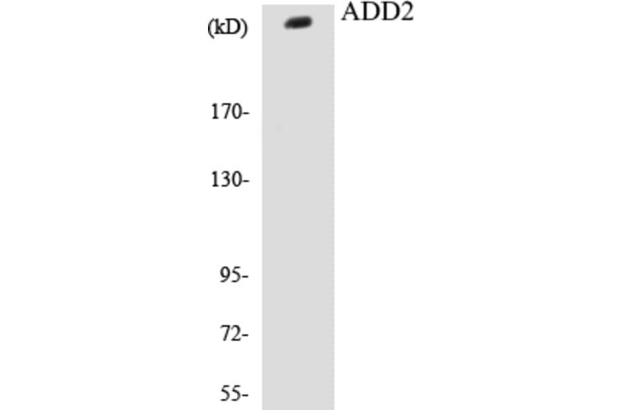 Western Blot - ADD2 Cell Based ELISA Kit (CB5024) - Antibodies.com