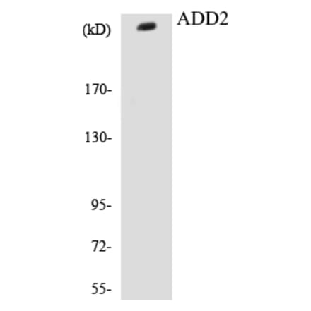 Western Blot - ADD2 Cell Based ELISA Kit (CB5024) - Antibodies.com