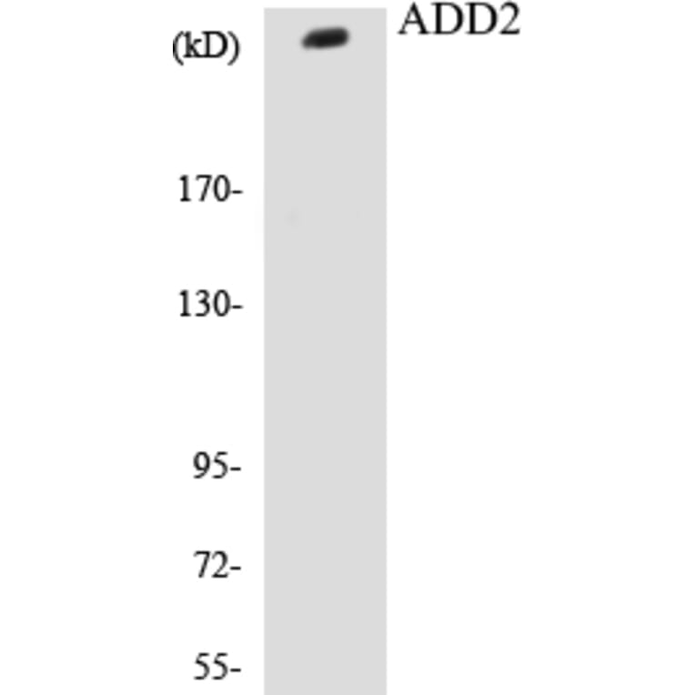 Western Blot - ADD2 Cell Based ELISA Kit (CB5024) - Antibodies.com