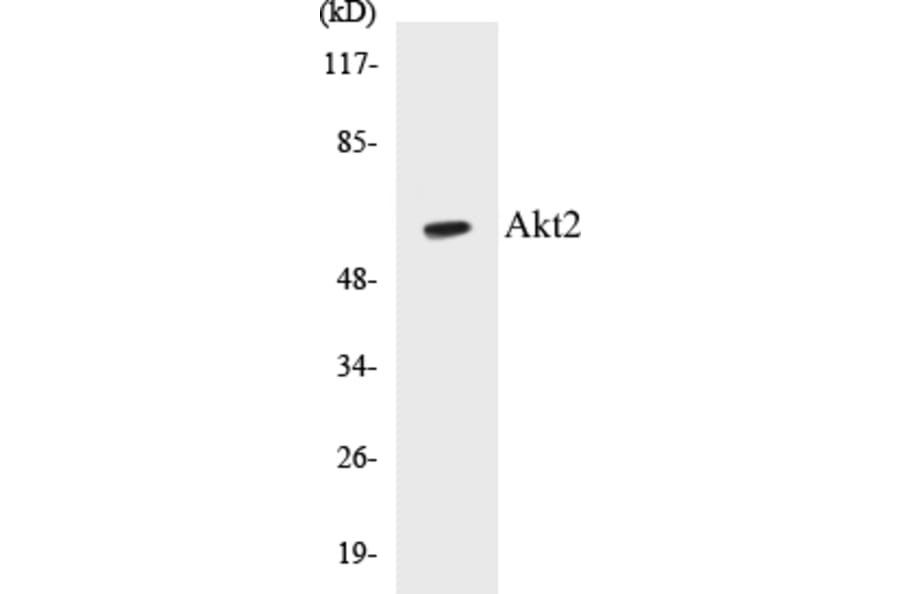 Western Blot - Akt2 Cell Based ELISA Kit (CB5031) - Antibodies.com