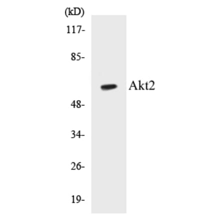 Western Blot - Akt2 Cell Based ELISA Kit (CB5031) - Antibodies.com