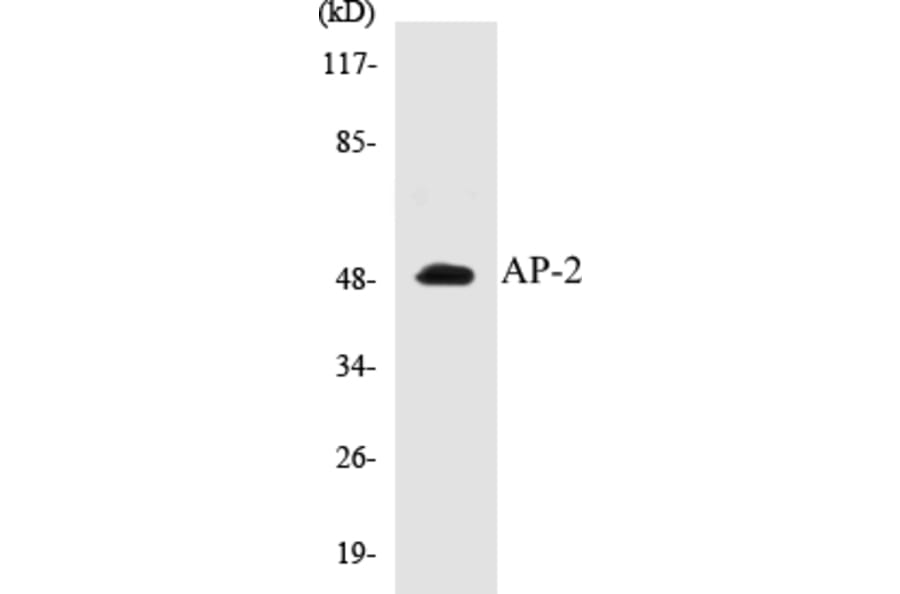 Western Blot - AP-2 Cell Based ELISA Kit (CB5043) - Antibodies.com