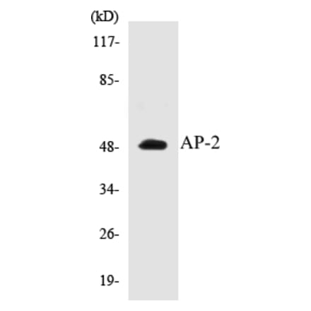 Western Blot - AP-2 Cell Based ELISA Kit (CB5043) - Antibodies.com