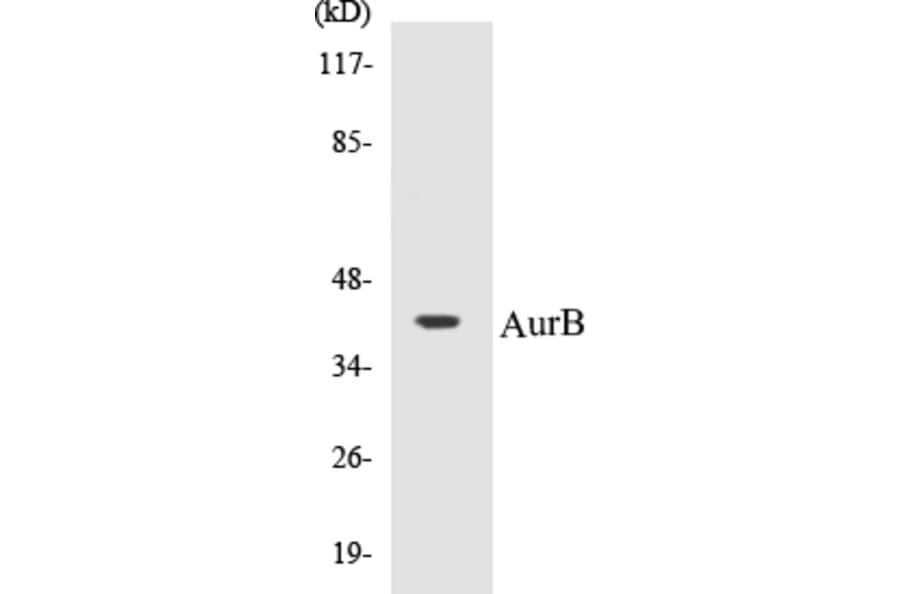 Western Blot - AurB Cell Based ELISA Kit (CB5062) - Antibodies.com