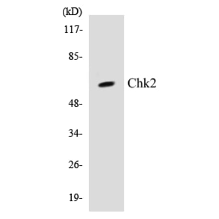 Western Blot - Chk2 Cell Based ELISA Kit (CB5136) - Antibodies.com