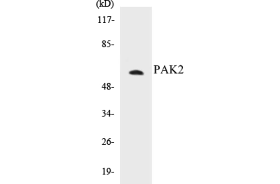 Western Blot - PAK2 Cell Based ELISA Kit (CB5530) - Antibodies.com