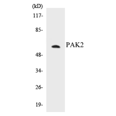 Western Blot - PAK2 Cell Based ELISA Kit (CB5530) - Antibodies.com