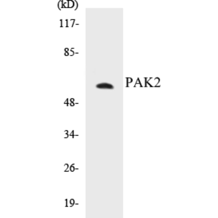Western Blot - PAK2 Cell Based ELISA Kit (CB5530) - Antibodies.com
