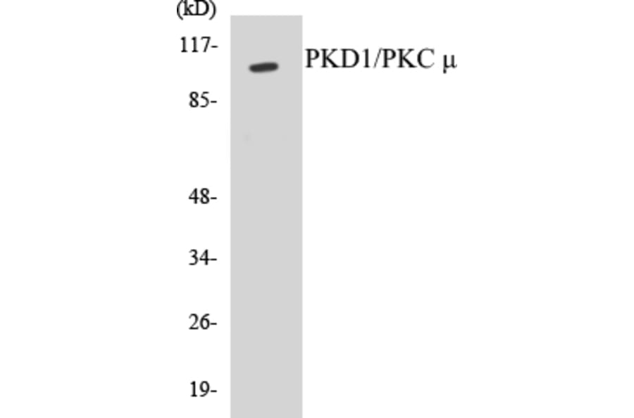 Western Blot - PKD1 Cell Based ELISA Kit (CB5570) - Antibodies.com