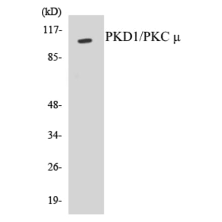 Western Blot - PKD1 Cell Based ELISA Kit (CB5570) - Antibodies.com