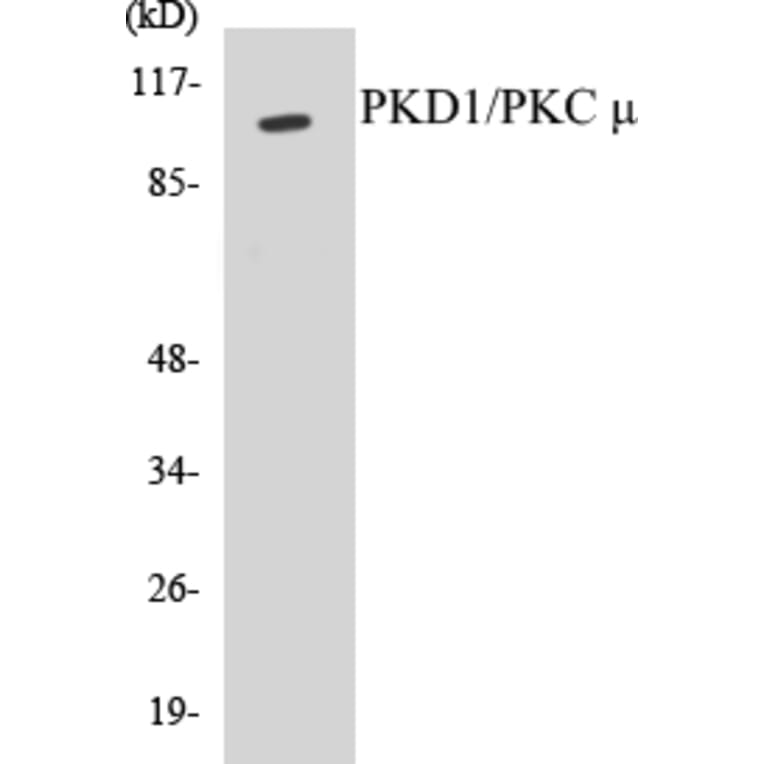 Western Blot - PKD1 Cell Based ELISA Kit (CB5570) - Antibodies.com