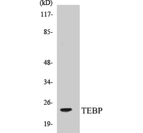 Western Blot - TEBP Cell Based ELISA Kit (CB5677) - Antibodies.com