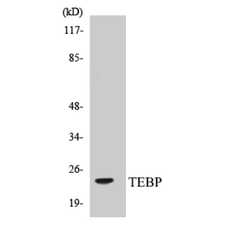 Western Blot - TEBP Cell Based ELISA Kit (CB5677) - Antibodies.com