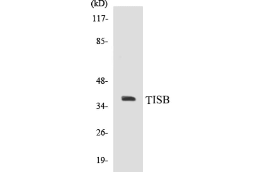 Western Blot - TISB Cell Based ELISA Kit (CB5695) - Antibodies.com