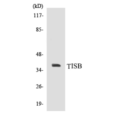 Western Blot - TISB Cell Based ELISA Kit (CB5695) - Antibodies.com