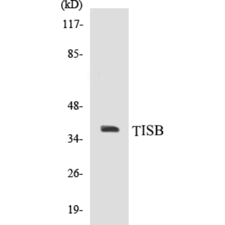 Western Blot - TISB Cell Based ELISA Kit (CB5695) - Antibodies.com