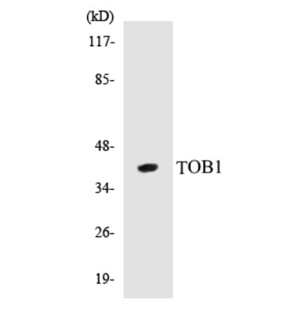 Western Blot - TOB1 Cell Based ELISA Kit (CB5697) - Antibodies.com