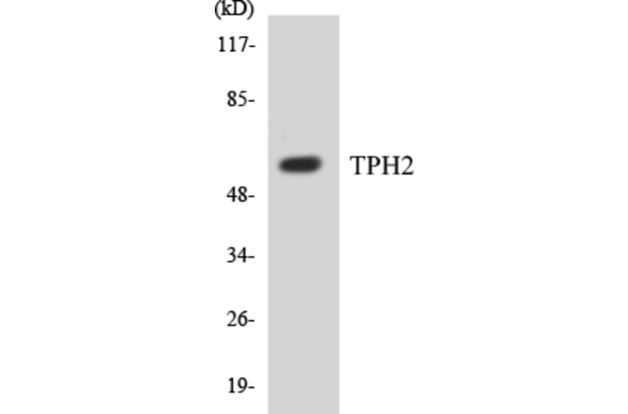 Western Blot - TPH2 Cell Based ELISA Kit (CB5700) - Antibodies.com