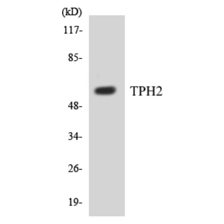 Western Blot - TPH2 Cell Based ELISA Kit (CB5700) - Antibodies.com