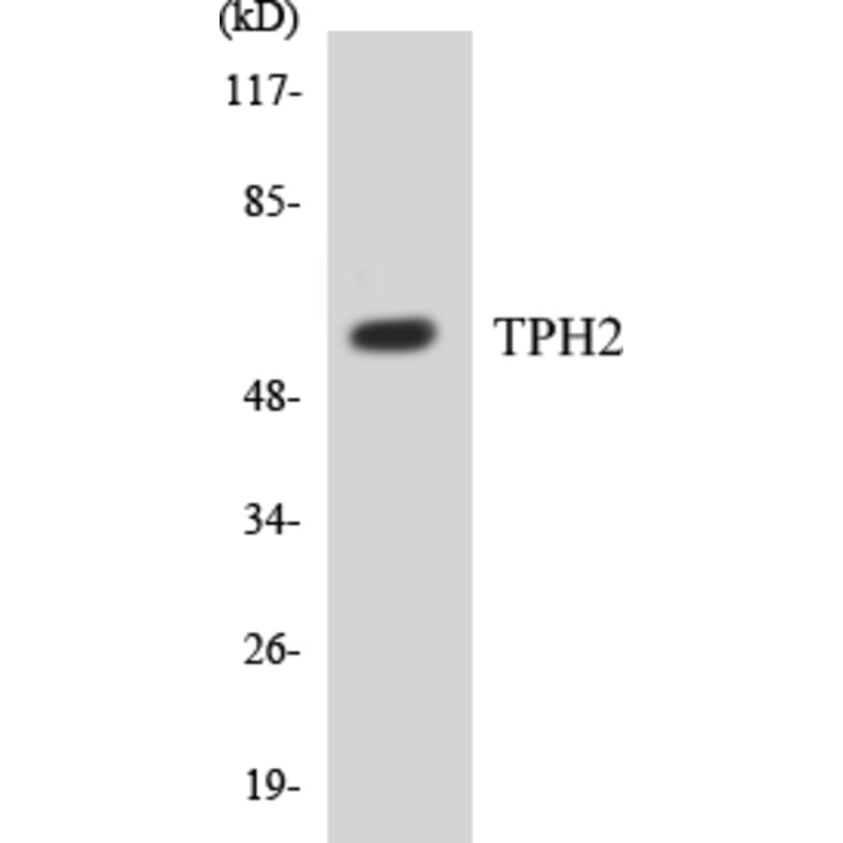 Western Blot - TPH2 Cell Based ELISA Kit (CB5700) - Antibodies.com