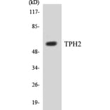 Western Blot - TPH2 Cell Based ELISA Kit (CB5700) - Antibodies.com
