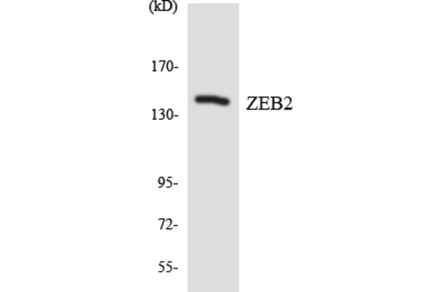 Western Blot - ZEB2 Cell Based ELISA Kit (CB5788) - Antibodies.com