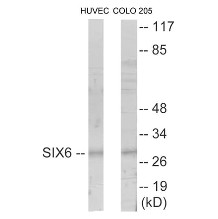 Western Blot - SIX6 Cell Based ELISA Kit (CB5822) - Antibodies.com