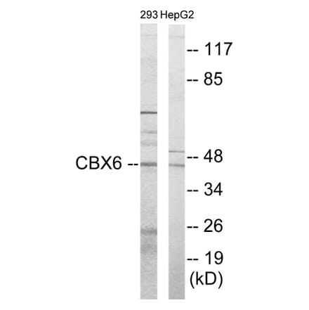 Western Blot - CBX6 Cell Based ELISA Kit (CB5823) - Antibodies.com