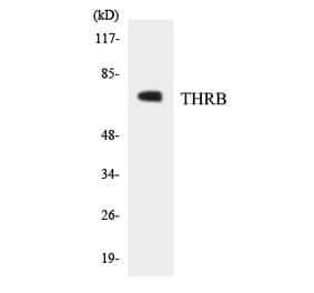 Western Blot - THRB Cell Based ELISA Kit (CB5829) - Antibodies.com