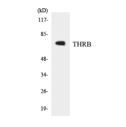 Western Blot - THRB Cell Based ELISA Kit (CB5829) - Antibodies.com