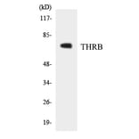 Western Blot - THRB Cell Based ELISA Kit (CB5829) - Antibodies.com